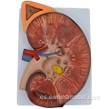 Modelo de anatomía renal ampliada